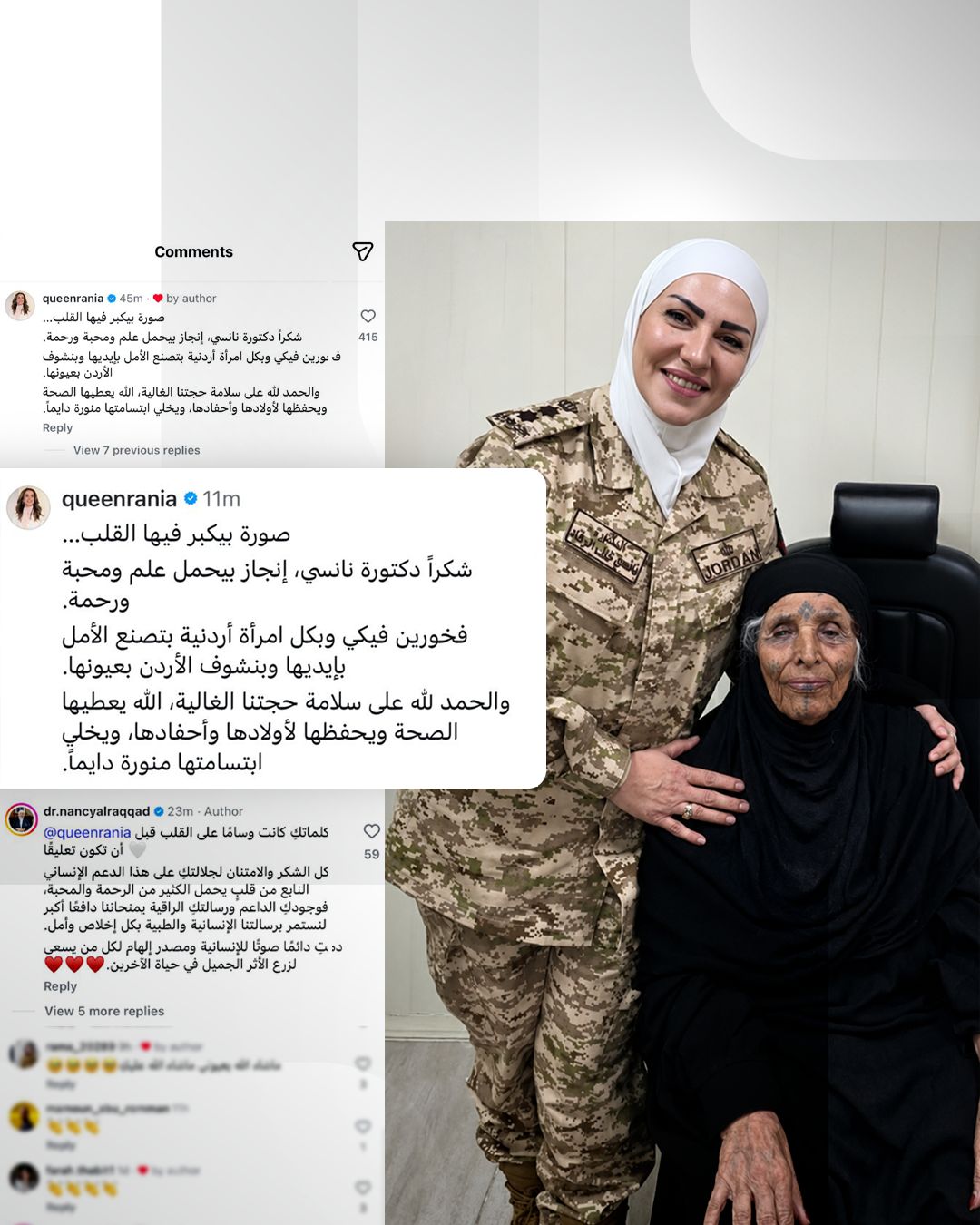 إشادة ملكية بإنجاز د. نانسي الرقاد في زراعة القرنية الصناعية لمعمّرة أردنية